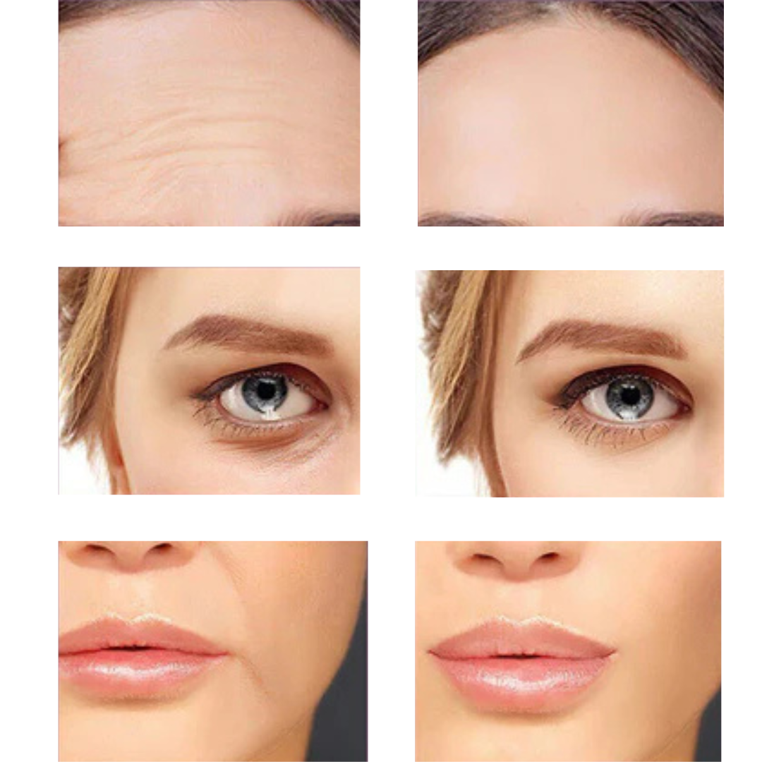 Masajeador Facial Microcorriente SkinGlow ™️ + 🎁 GRATIS 👉 Gel conductor