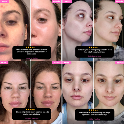 Beauty Ice Roller: Molde para masajeador de hielo para rostro y cuello ®