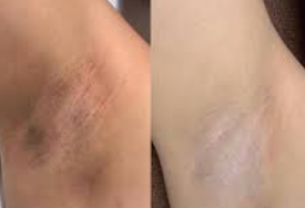 Carla Medina – Chiclayo