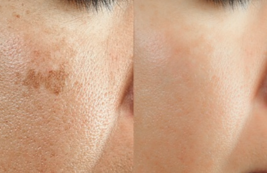 María Fernanda – Surco